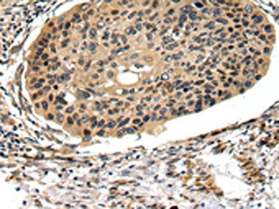 FOXK1 Antibody