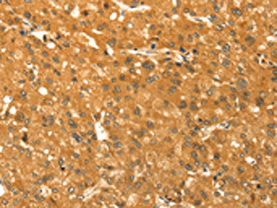 TM7SF2 Antibody