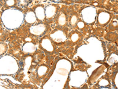 TM7SF2 Antibody