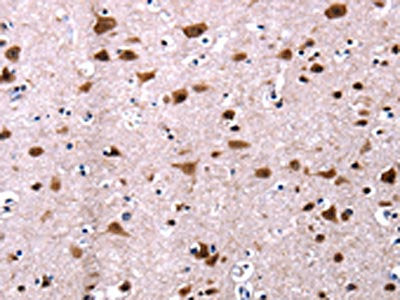 CSNK2A1 Antibody