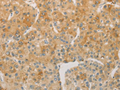 ACSL4 Antibody