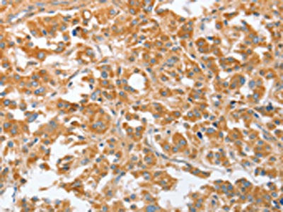 CDR2 Antibody