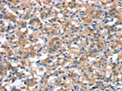 ANP32C Antibody