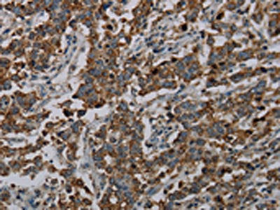 CFLAR Antibody