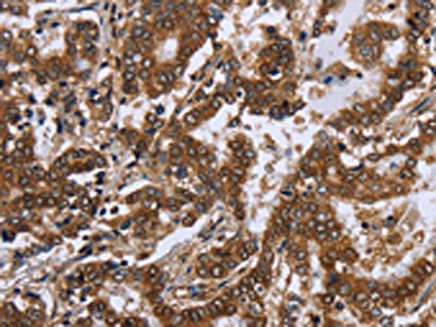 FGF21 Antibody