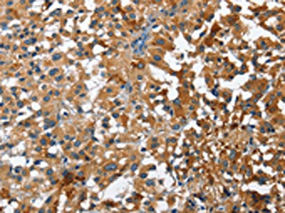 STK17B Antibody