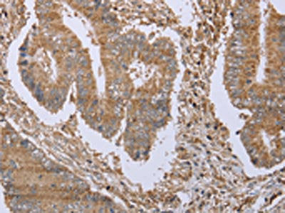 FHL1 Antibody