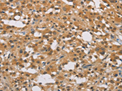 DDX43 Antibody