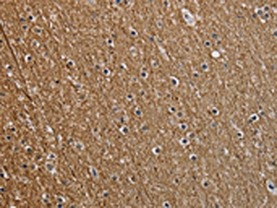 NEFM Antibody