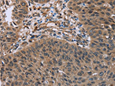 HOMER1 Antibody
