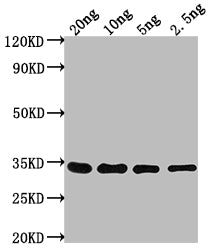 CHD1 Antibody