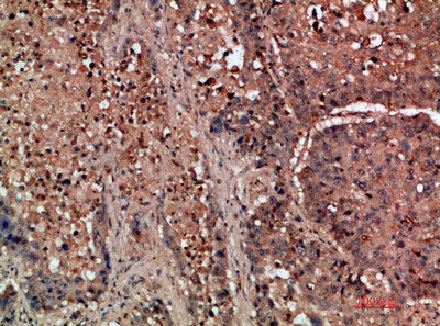 DDR2 Antibody