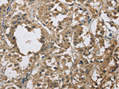 DSG2 Antibody