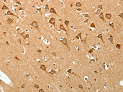 PGBD5 Antibody