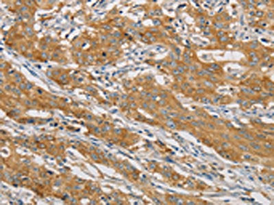 ARHGEF7 Antibody