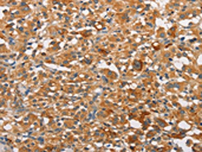PRKCE Antibody