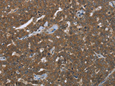 FASTKD1 Antibody