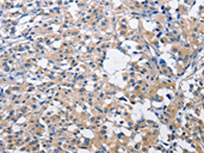 PIM2 Antibody