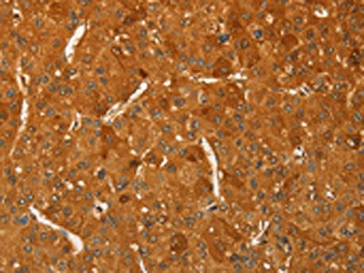 RPL26L1 Antibody