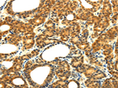 SOCS5 Antibody