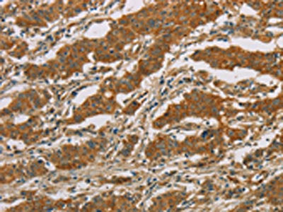 CYP39A1 Antibody
