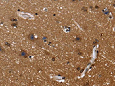 FGFR1OP Antibody