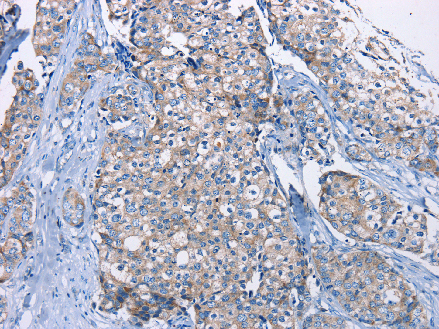 DMD Antibody