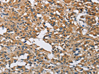DNMT3A Antibody