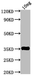 TNF Antibody