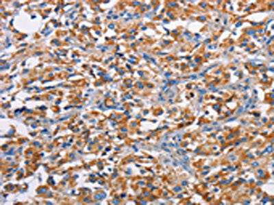 PIM2 Antibody
