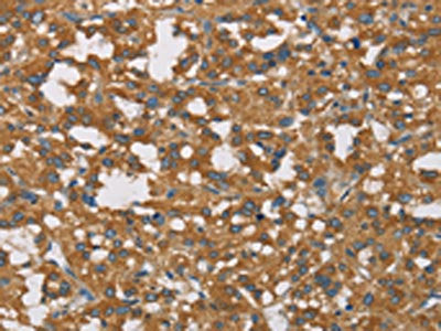 DCTN1 Antibody