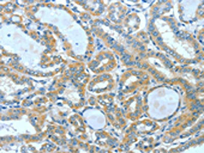 SPHK2 Antibody