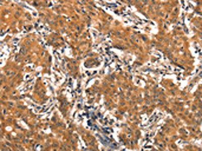EPPIN Antibody