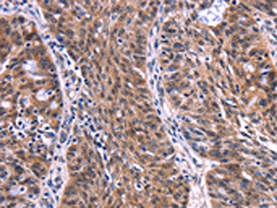 EIF2AK4 Antibody