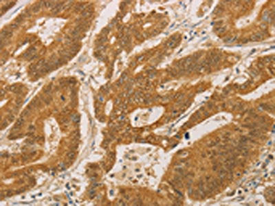 PSMB7 Antibody