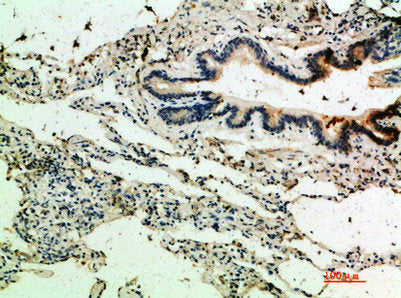 THBS4 Antibody