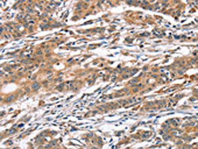 CAMK4 Antibody