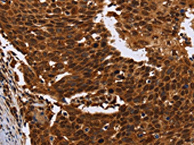 FANCF Antibody