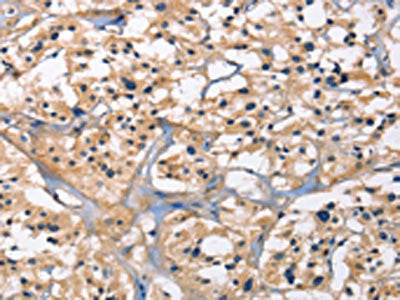 CAPZA2 Antibody