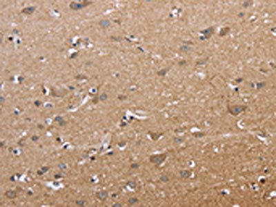 MAPRE3 Antibody
