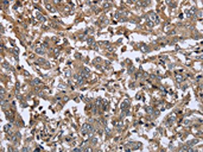 FCAR Antibody