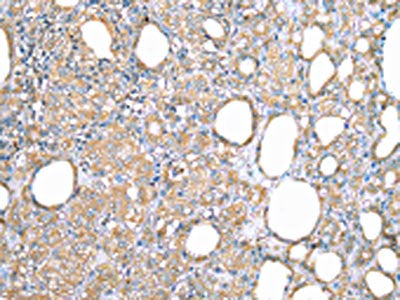 VAPA Antibody