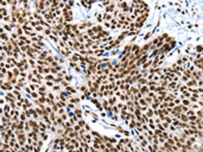 XRCC6 Antibody