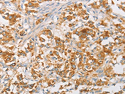 NPPB Antibody