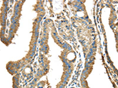 NME2 Antibody