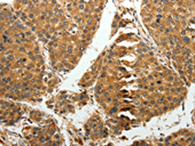 RRM1 Antibody