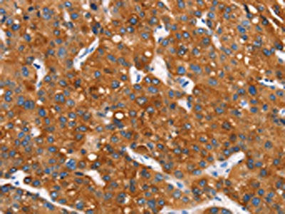 MT-CYB Antibody