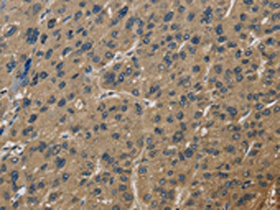 CORO1C Antibody