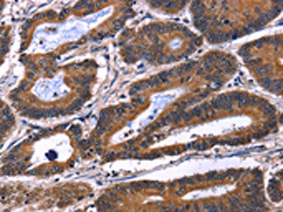 IL1A Antibody