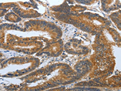 PSCA Antibody